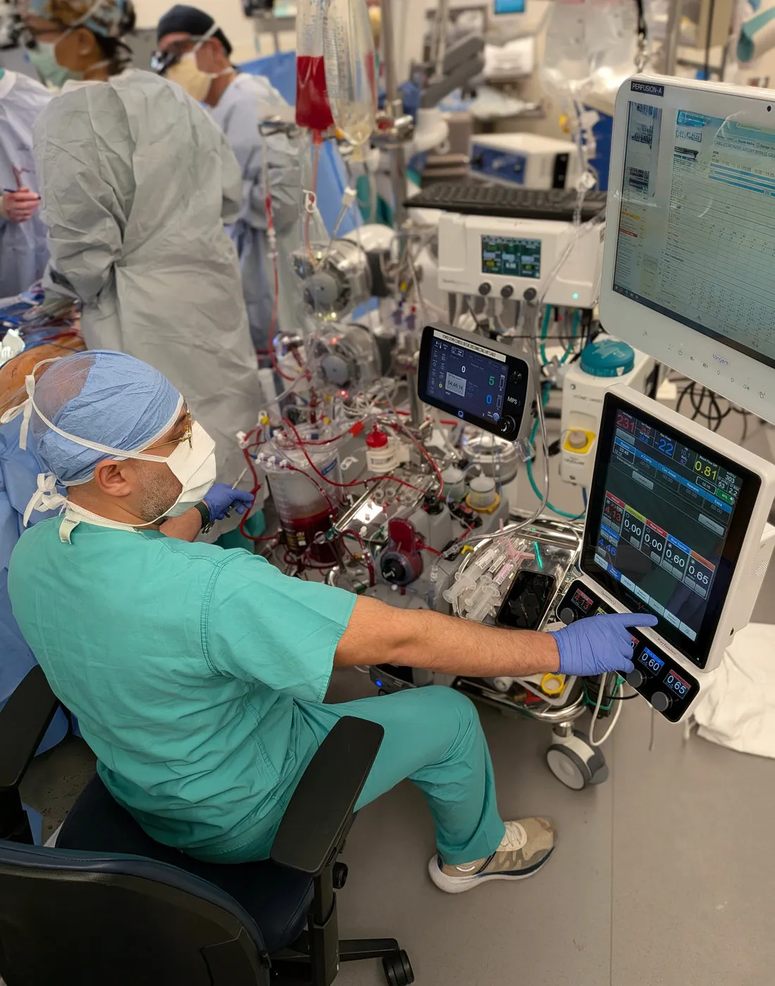 A clinical perfusionist operating a heart-lung perfusion console during an organ recovery procedure.